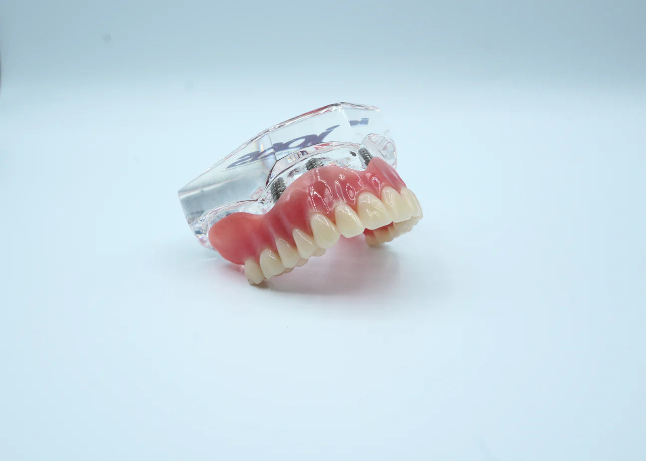 4 Implant Upper Overdenture Jaw Model