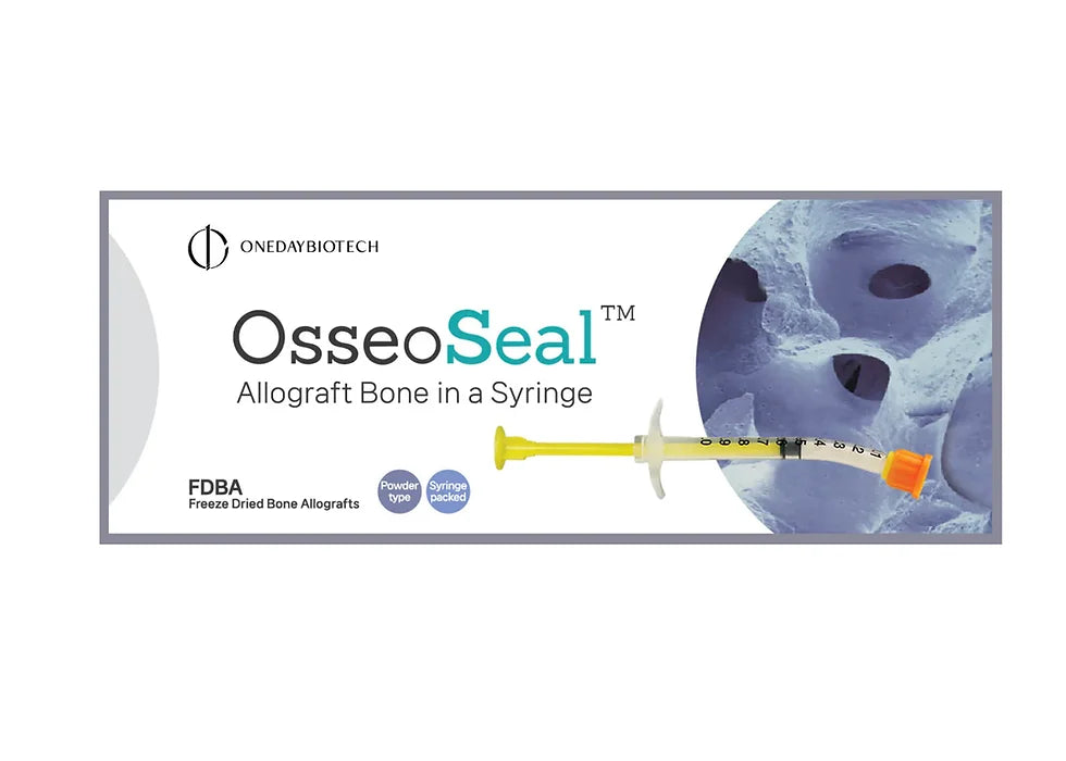 OsseoSeal Prefilled Allograft Bone in Syringe